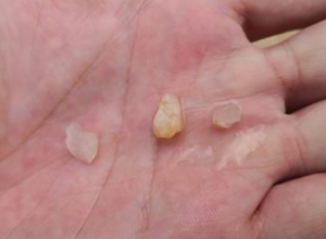 Q.クリスタルビーチの石はクリスタル?